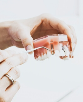 Dental Implant Demo